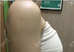 什么样的顶部嵌入广告符合体验标准?看这里-seo教程,图片包含大量水印,什么样的顶部嵌入广告符合体验标准?看这里,第11张