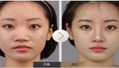 搜索干货(一):如何设计才能提升网站页面的用户体验-seo教程,图片广告内容中不能有侵犯个人肖像权及不符合规范的内容,搜索干货(一):如何设计才能提升网站页面的用户体验,第19张